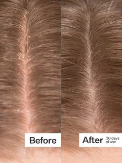 Act+Acre Microbiome Cooling Scalp Serum | MECCA