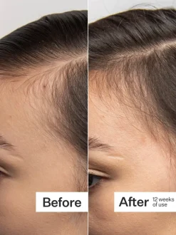 Act+Acre 0.25mm Scalp Dermaroller | MECCA