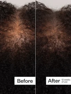 Act+Acre 0.25mm Scalp Dermaroller | MECCA