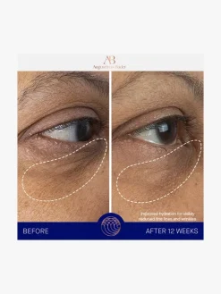 Augustinus Bader The Eye Cream | MECCA