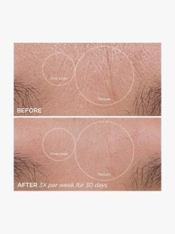 BeautyBio GloPro® Face Microtip™ | MECCA