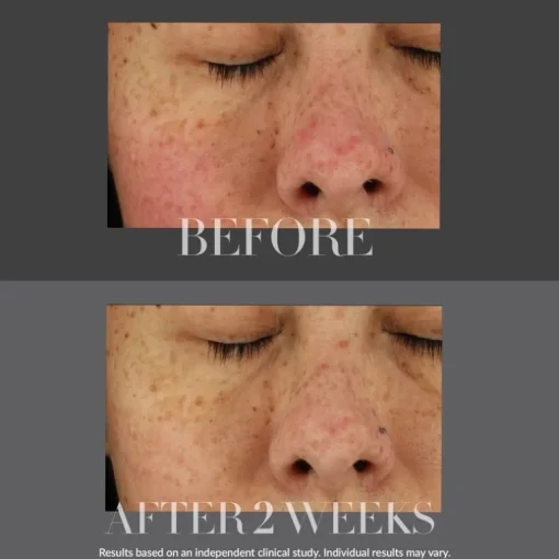 Kate Somerville Total Repair Cream KateCeuticals | MECCA