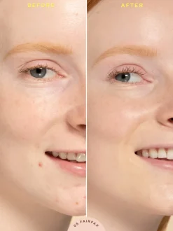 Tower 28 SunnyDays SPF 30 Tinted Sunscreen Foundation | MECCA